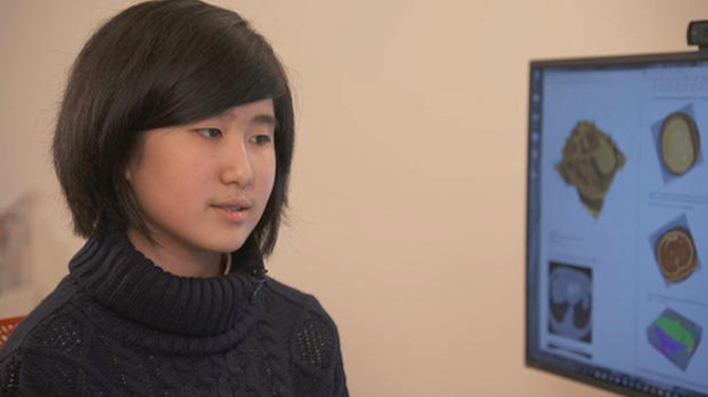 【美国14岁华裔学生开发app,帮助阿兹海默症